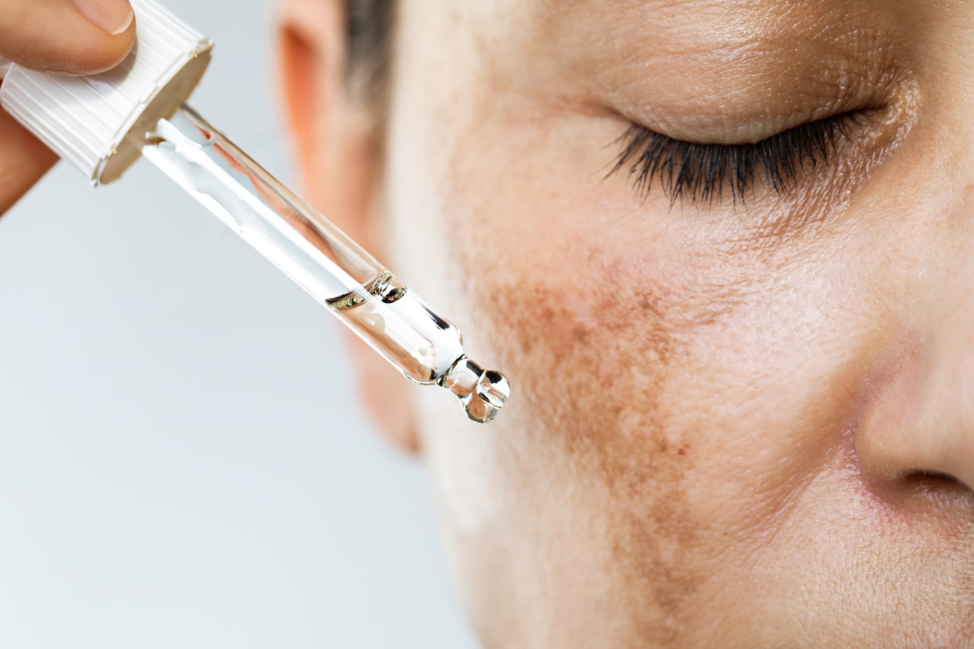 Dermatologie Esthétique